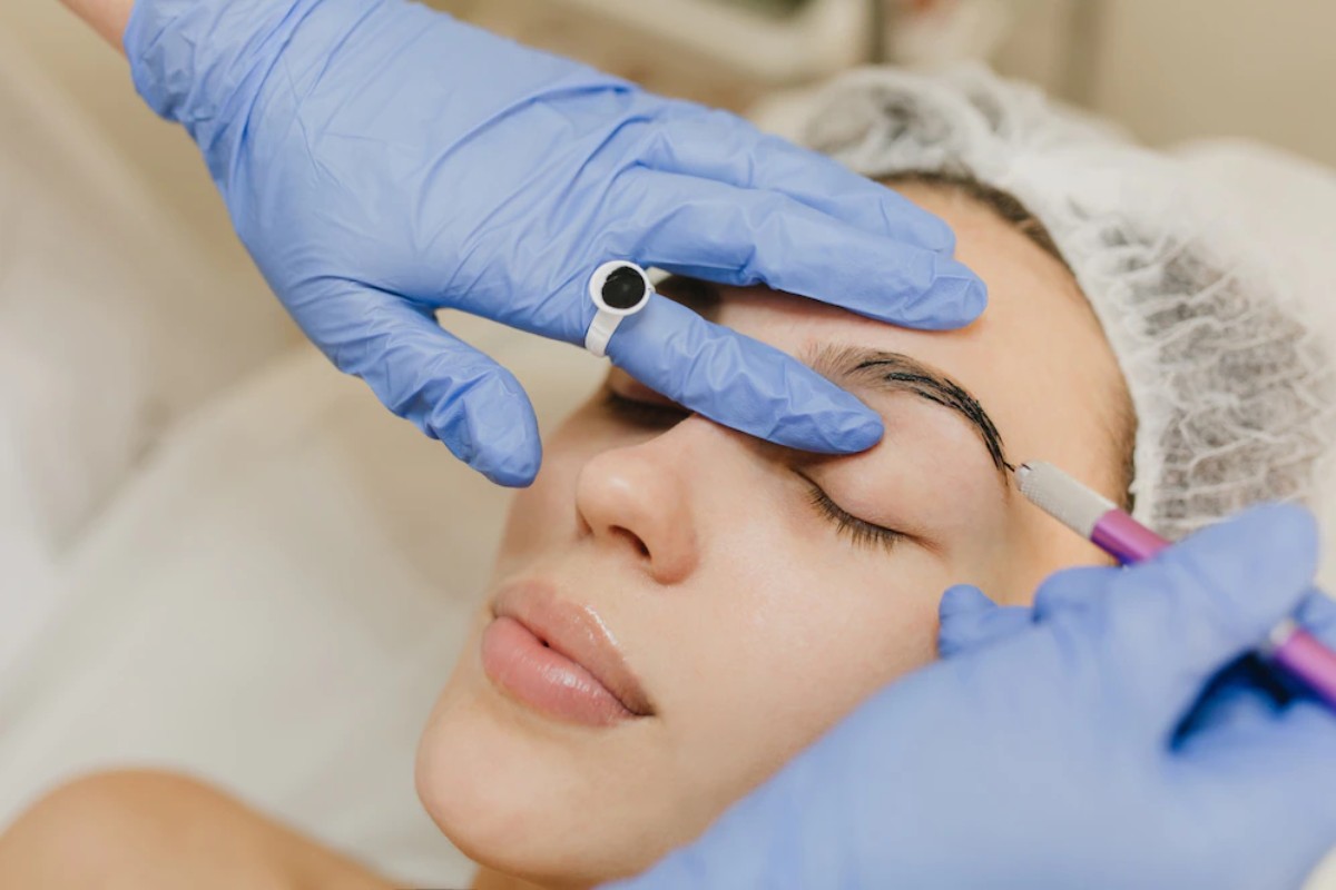 What is a brow lift?